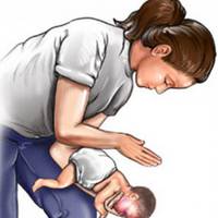 “Батьки! Ви повинні це знати і пам’ятати”: перша допомога дитині яка подавилася