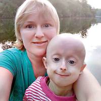 «ХОТІЛА СТРИБНУТИ З ДИТИНОЮ З БАГАТОПОВЕРХІВКИ, ЩОБ ДОНЬКА ТАК НЕ МУЧИЛАСЯ» – СПОВІДЬ МАТЕРІ