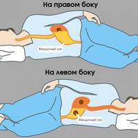 Ось що з вами відбувається, коли ви спите на лівій стороні. Можливо, ви теж спите неправильно