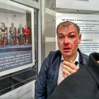 Націоналісти жорстоко побили Савченко, фото і подробиці події