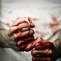 У Туреччині росіянин до смерті побив українця: житель Запоріжжя четвертий день в комі