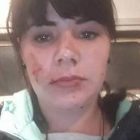 Біля Львова невідомі кинули в електричку камінь, постраждала дівчина