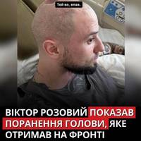 Український комік та зірка «Ліги Сміху» Віктор Розовий вперше показав прооперовану голову після важкого поранення на фронті.